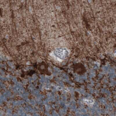 Immunohistochemistry-Paraffin: GAD1/GAD67 Antibody (CL2914) [NBP2-46638]