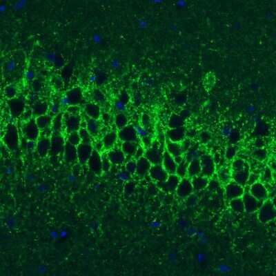 Immunohistochemistry: GAD1/GAD67 Antibody (CL2919) [NBP2-46639]