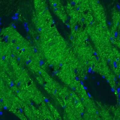 Immunohistochemistry: GAD1/GAD67 Antibody (CL2919) [NBP2-46639]