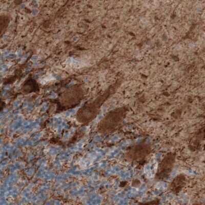 Immunohistochemistry: GAD1/GAD67 Antibody (CL2919) [NBP2-46639]