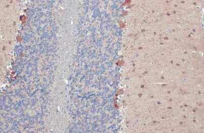 Immunohistochemistry-Paraffin: GAD1/GAD67 Antibody (HL1096) [NBP3-13716]