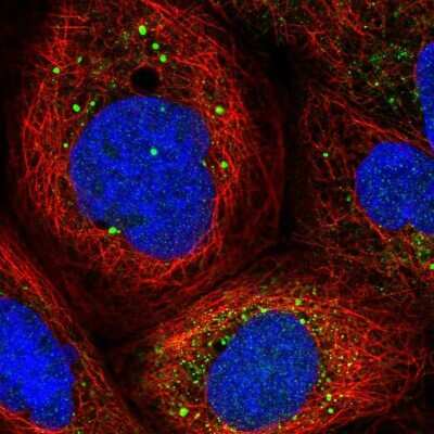 Immunocytochemistry/ Immunofluorescence: GAD1/GAD67 Antibody [NBP2-58132]