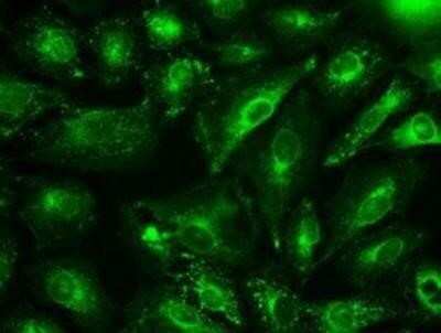 Immunocytochemistry/ Immunofluorescence: GAD1/GAD67 Antibody (OTI3G9) - Azide and BSA Free [NBP2-70791]