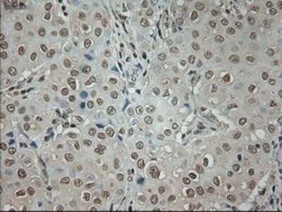 Immunohistochemistry: GAD1/GAD67 Antibody (OTI3G9) - Azide and BSA Free [NBP2-70791]