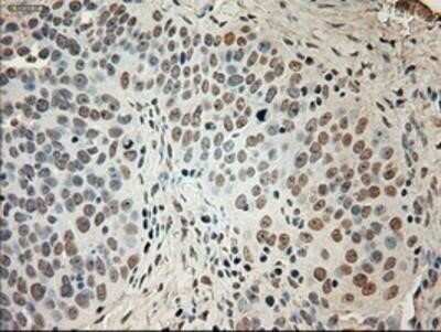 Immunohistochemistry: GAD1/GAD67 Antibody (OTI3G9) - Azide and BSA Free [NBP2-70791]