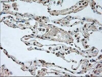 Immunohistochemistry: GAD1/GAD67 Antibody (OTI3G9) - Azide and BSA Free [NBP2-70791]