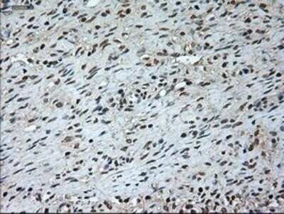 Immunohistochemistry: GAD1/GAD67 Antibody (OTI3G9) - Azide and BSA Free [NBP2-70791]