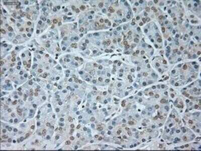 Immunohistochemistry: GAD1/GAD67 Antibody (OTI3G9) - Azide and BSA Free [NBP2-70791]