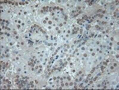Immunohistochemistry-Paraffin: GAD1/GAD67 Antibody (OTI3G9) [NBP1-48272]