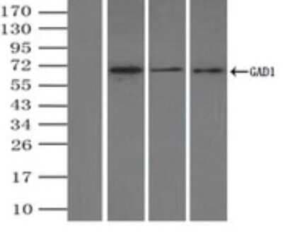 Immunoprecipitation: GAD1/GAD67 Antibody (OTI3G9) [NBP1-48272]