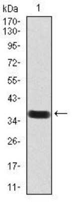 Western Blot: GAD2/GAD65 Antibody (5D9G12)BSA Free [NBP2-52471]
