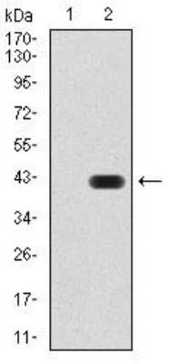 Western Blot: GAD2/GAD65 Antibody (5D9G9)BSA Free [NBP2-52470]