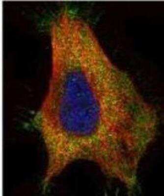 Immunocytochemistry/ Immunofluorescence: GAD2/GAD65 Antibody [NBP1-33284]