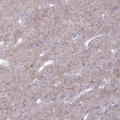 Immunohistochemistry-Paraffin: GAD2/GAD65 Antibody [NBP1-89801]