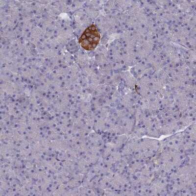 Immunohistochemistry-Paraffin: GAD2/GAD65 Antibody [NBP1-89801]