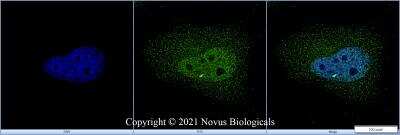 Immunocytochemistry/ Immunofluorescence: GADD153/CHOP Antibody - BSA Free [NBP2-13172]