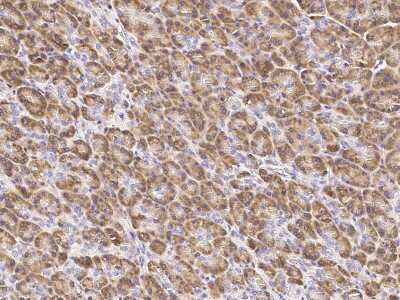Immunohistochemistry-Paraffin: GADD153/CHOP Antibody [NBP2-98742]