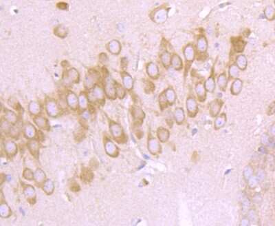 Immunohistochemistry-Paraffin: GADD153/CHOP Antibody (JM10-31) [NBP2-66856]