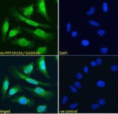 Immunocytochemistry/ Immunofluorescence: GADD34 Antibody [NB100-778]