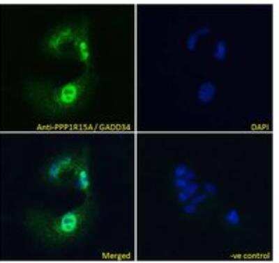 Immunocytochemistry/ Immunofluorescence: GADD34 Antibody [NB100-778]