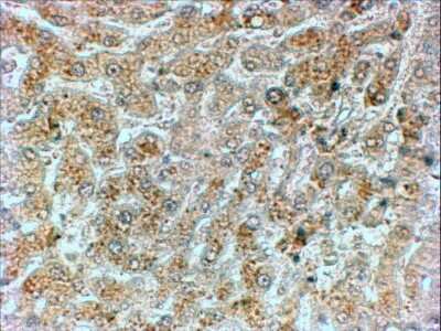 Immunohistochemistry-Paraffin: GADD34 Antibody [NB100-778]