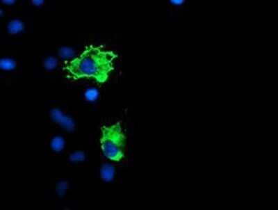 Immunocytochemistry/ Immunofluorescence: GADD34 Antibody (OTI3D12) - Azide and BSA Free [NBP2-71765]