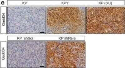 Immunohistochemistry: GADD34 Antibody (OTI3D12) [NBP2-01787]