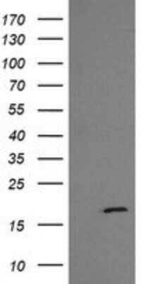 Western Blot: GADD45G Antibody (OTI2F12) [NBP2-45807]