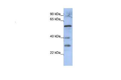 Western Blot: GADL1 Antibody [NBP1-79612]