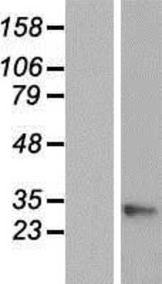 Western Blot: GAJ Overexpression Lysate [NBP2-06069]