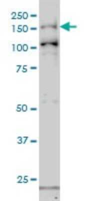 Western Blot: GAK Antibody (4C10) [H00002580-M01]