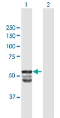 Western Blot: GAL3ST1 Antibody [H00009514-B01P]