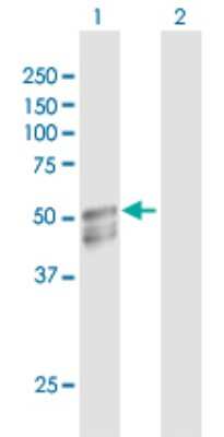 Western Blot: GAL3ST1 Antibody [H00009514-D01P]