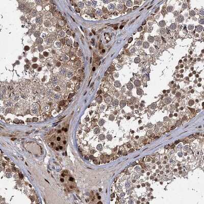 Immunohistochemistry-Paraffin: GAL3ST4 Antibody [NBP1-82309]