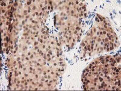 Immunohistochemistry-Paraffin: GALE Antibody (OTI1C4) [NBP2-03390]