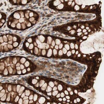 Immunohistochemistry-Paraffin: GALE Antibody [NBP1-87066]