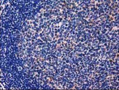 Immunohistochemistry: GALE Antibody (OTI1C4) - Azide and BSA Free [NBP2-70793]