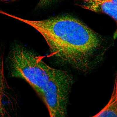 Immunocytochemistry/ Immunofluorescence: GALK1 Antibody [NBP1-81853]