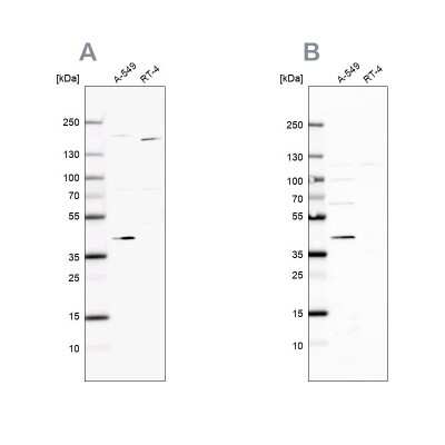 Western Blot: GALK1 Antibody [NBP1-81853]