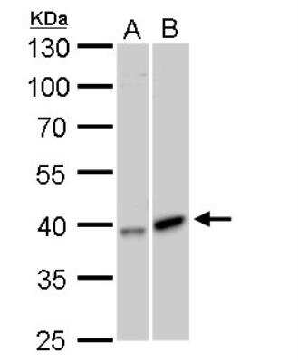 Western Blot: GALK1 Antibody [NBP2-16591]