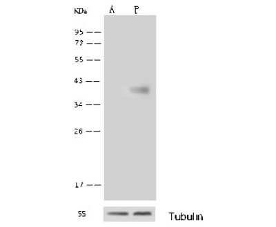 Western Blot: GALK1 Antibody [NBP2-99783]