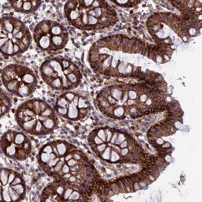 Immunohistochemistry: GALK2 Antibody [NBP2-47451]