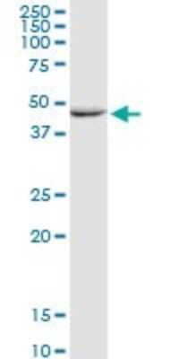 Western Blot: GALK2 Antibody [H00002585-D01P]