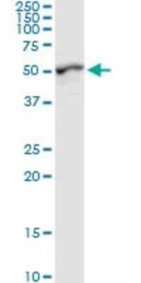 Western Blot: GALK2 Antibody [H00002585-D01P]