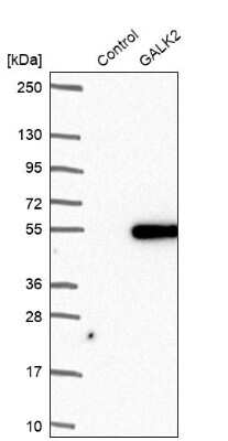 Western Blot: GALK2 Antibody [NBP2-47451]