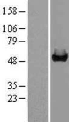 Western Blot: GALK2 Overexpression Lysate [NBL1-10949]