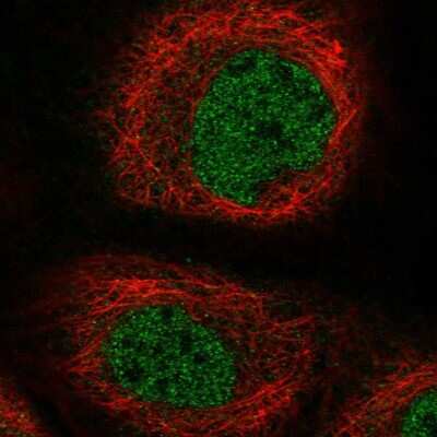 Immunocytochemistry/ Immunofluorescence: GALM Antibody [NBP2-38252]