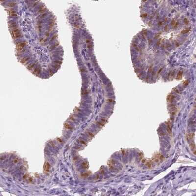 Immunohistochemistry: GALM Antibody [NBP2-38252]