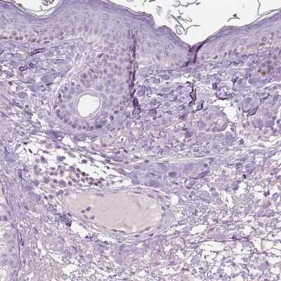 Immunohistochemistry-Paraffin: GALM Antibody [NBP1-85906]