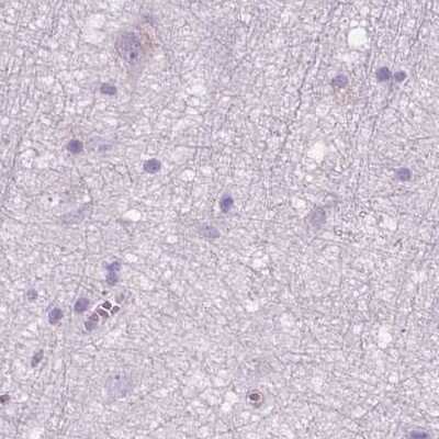Immunohistochemistry-Paraffin: GALM Antibody [NBP1-85906]